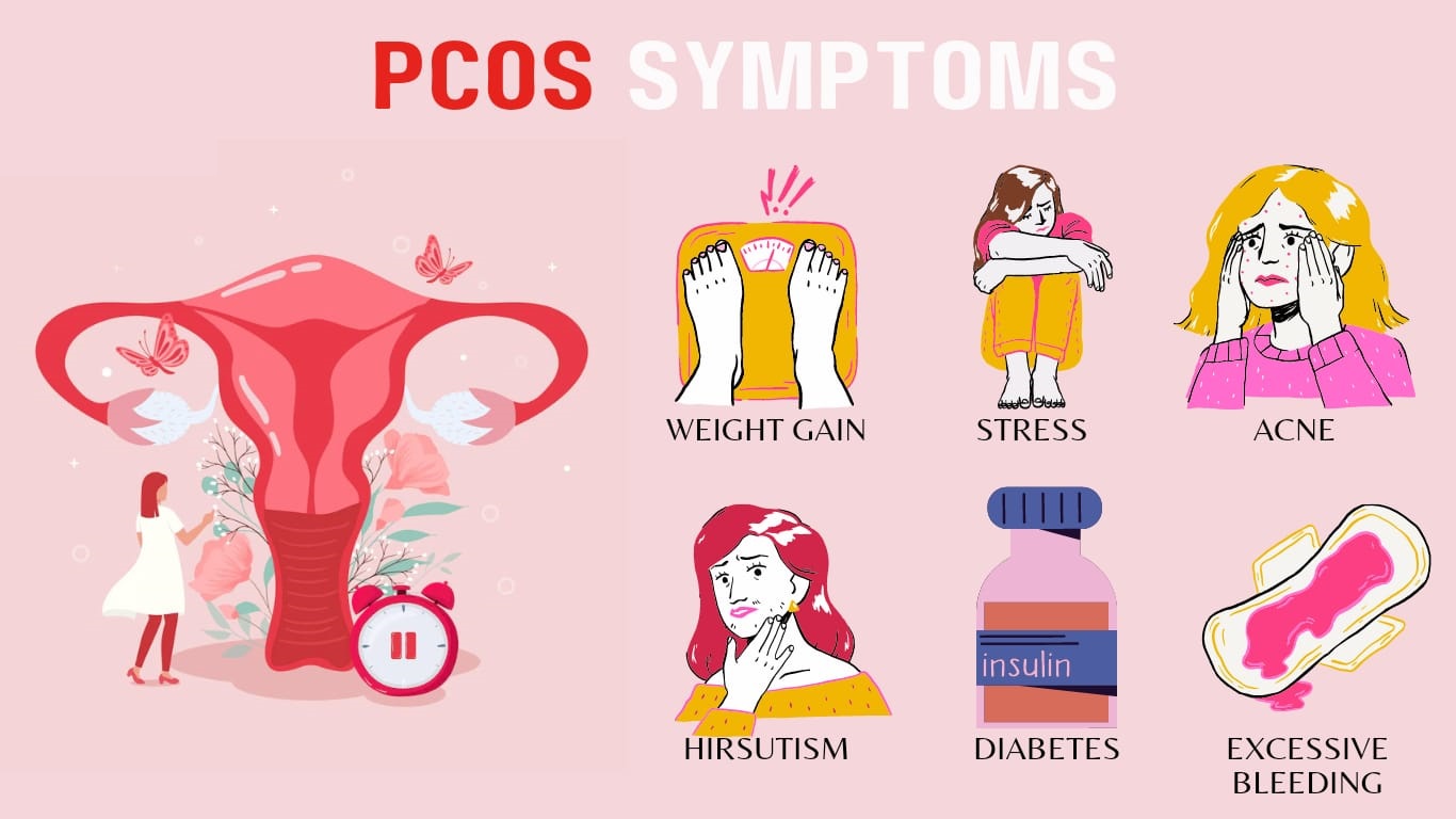 PCOS VS PCOD HC Deck HC Deck PCOS VS PCOD